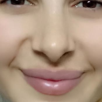 Rinoplasti Sonrası Hayal Kırıklığı Ve İletişim Sorunları