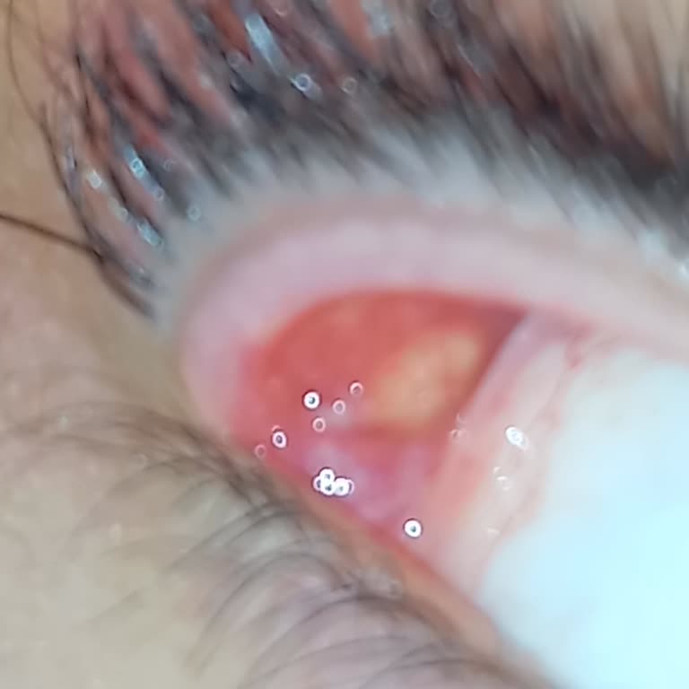 Arifoğlu Kirpik Serumu Sağlık Sorunlarına Yol Açtı