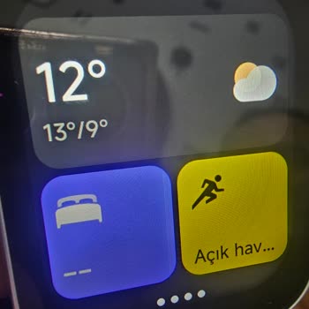 Çizik Ekranla Gelen Xiaomi Watch 5 Active Hayal Kırıklığı