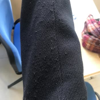 Zara Ceket Kalitesizliği: Hızlı Yıpranma Sorunu