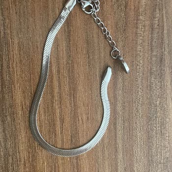 Fenerium'dan Aldığım Bileklik Aniden Koptu: Kesin Çözüm Bekliyorum