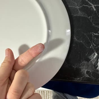 Hepsiburada Kırık Gelen Aryıldız Yemek Takımı Ve Şüpheli Orijinallik!