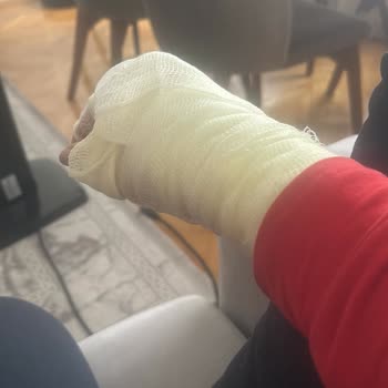 Fissler Düdüklü Tencere Patlamasıyla Yaşanan Tehlike