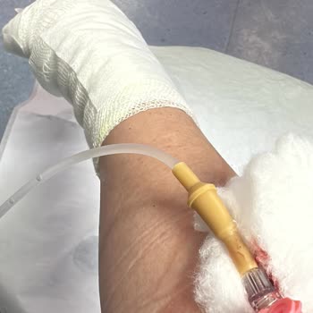 Fissler Düdüklü Tencere Patlamasıyla Yaşanan Tehlike