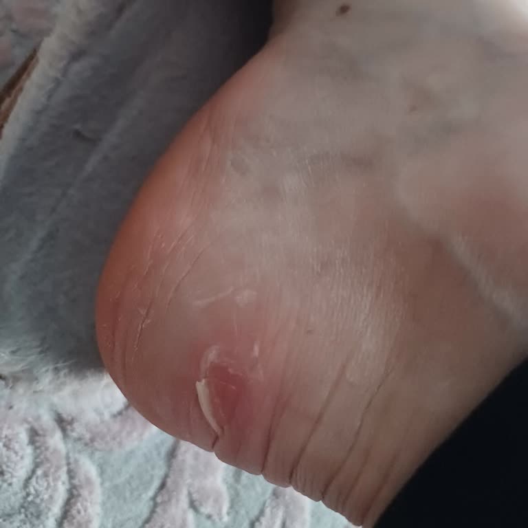 Tommy Hilfiger Botlar Ayaklarımı Mahvetti