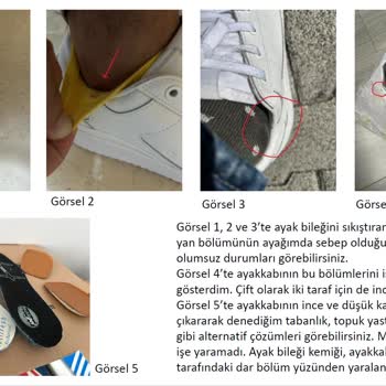 Fashfed Adidas Rahatsız Eden Ayakkabı Ve İlgisiz Satıcı Deneyimi