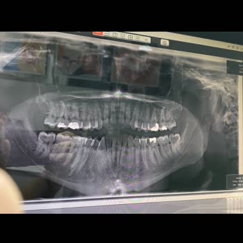 Haksız Ücretlendirme: 5 Dakikalık İşlem İçin 4000 TL!