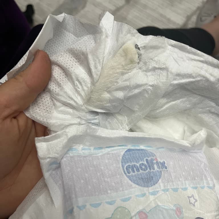 Molfix Paketi İçinden Çıkan Beklenmedik Sürpriz