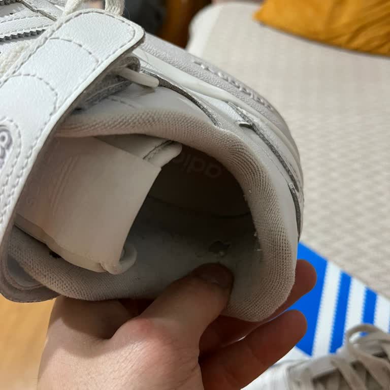 Adidas Ayakkabıda Beklenmedik Kalite Sorunu