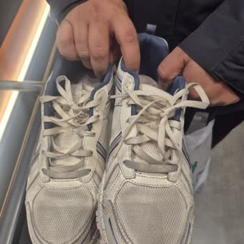 Skechers Ayakkabılarda Yırtılma Ve Renk Sorunu