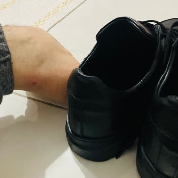 Ayakkabının İlk Giyimde Yara Yapması Ve İade Sorunu
