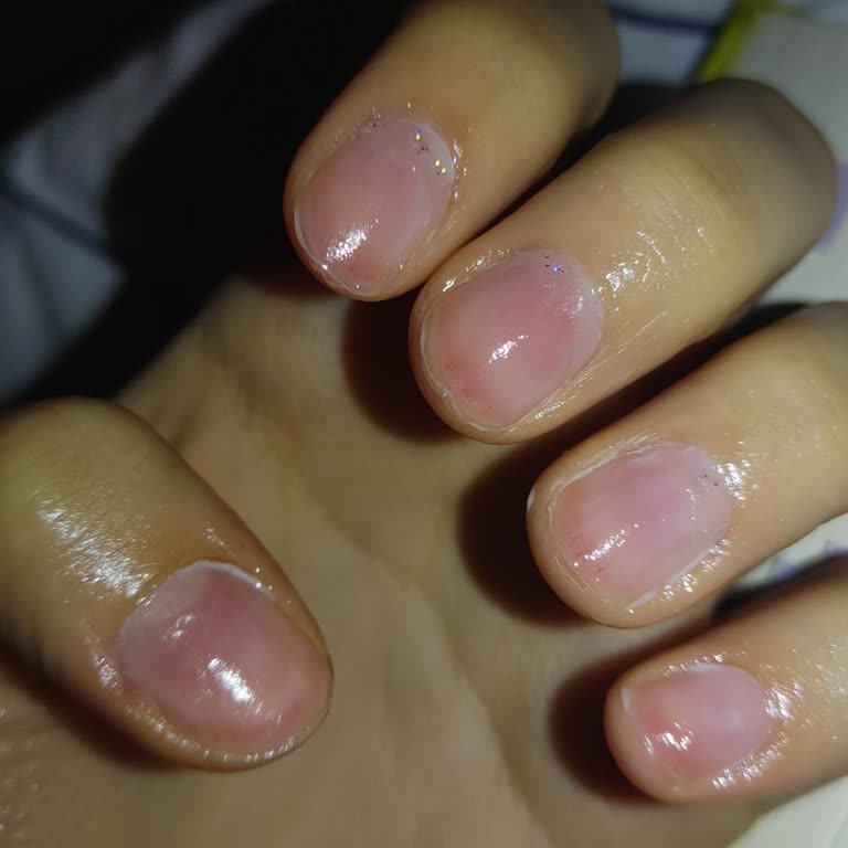 Protez Tırnak Kabusu: Tırnaklarım Kazındı Ve Acı İçindeyim!