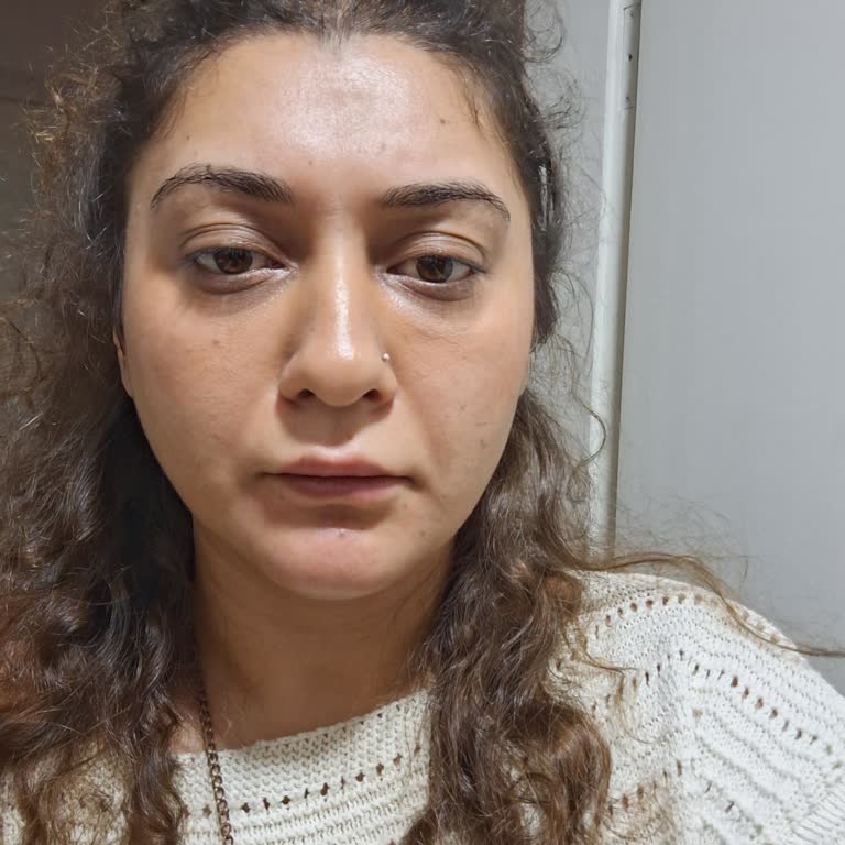 Gözaltı Dolgusu Sonrası Mağduriyet Ve Çelişkili Ücret Talebi