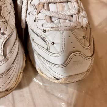 Skechers Ayakkabının Kalite Sorunu Ve İade Reddedilmesi