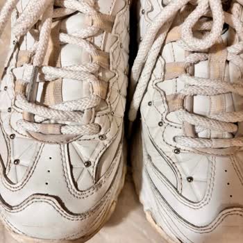 Skechers Ayakkabının Kalite Sorunu Ve İade Reddedilmesi