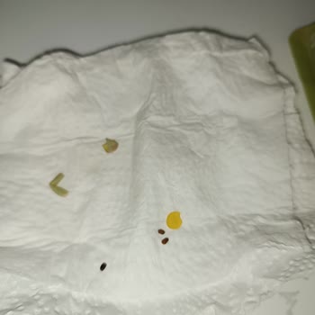 Hasata Ürünlerinde Böcek Sorunu Ve Müşteri Hizmetleri Ulaşılamazlığı