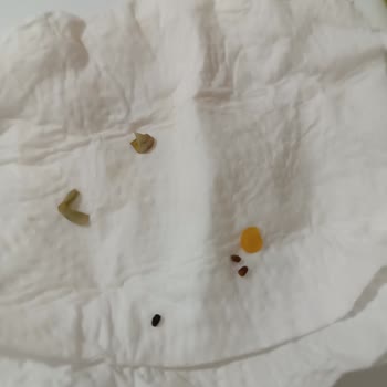 Hasata Ürünlerinde Böcek Sorunu Ve Müşteri Hizmetleri Ulaşılamazlığı