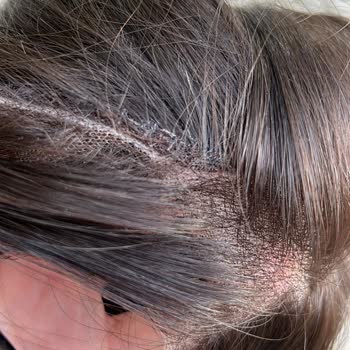 Pahalı Perukta Beklenmedik Kalitesizlik Ve Mağduriyet