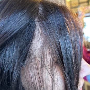 Pahalı Perukta Beklenmedik Kalitesizlik Ve Mağduriyet