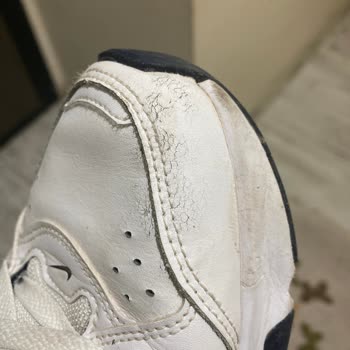 Ayakkabıda Deri Soyulması Ve Garanti Sorunu