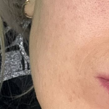 Cilt Bakım Ürünü Kullandıktan Sonra Beklenmedik Cilt Sorunları