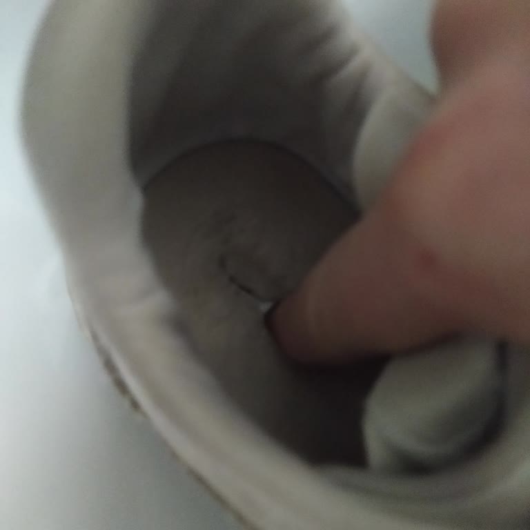 Trendyol Ayakkabının 3 Ayda Kullanılamaz Hale Gelmesi!