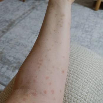 Fitforeverturkey.com'dan Şikayetçiyim