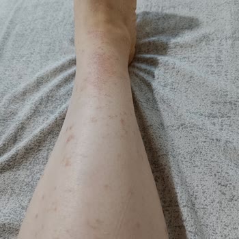 Fitforeverturkey.com'dan Şikayetçiyim