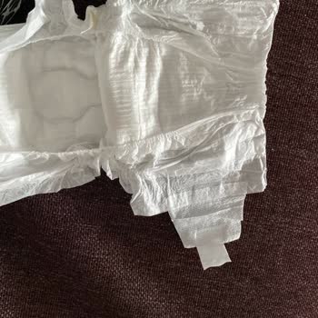 Hatalı Bebek Bezleri Ve İlgisiz Müşteri Hizmeti