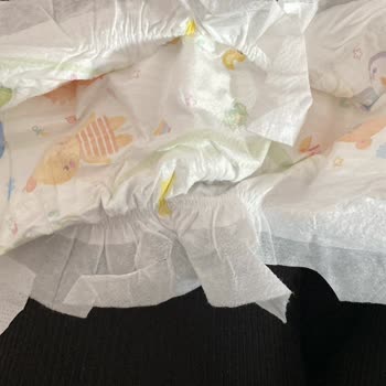Hatalı Bebek Bezleri Ve İlgisiz Müşteri Hizmeti