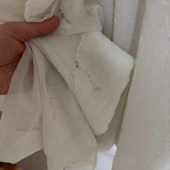 Havuz Personeli Ve Temizlik Sorunları