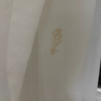 Havuz Personeli Ve Temizlik Sorunları