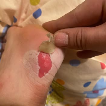 Harley Botları Ayağımı Mahvetti, Boyner İade Talebimi Reddetti!