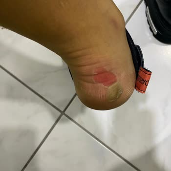 Harley Botları Ayağımı Mahvetti, Boyner İade Talebimi Reddetti!