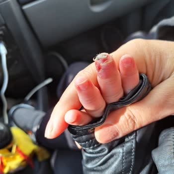 Büyük Anadolu Hastanesi Darıca Cildiye Doktoru Şikayeti