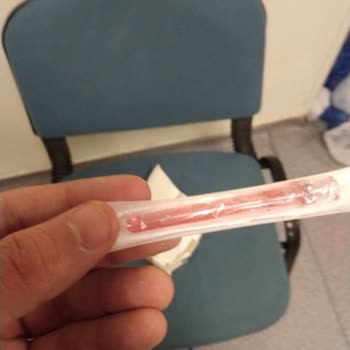 Göz Ameliyatında Çelişkili İğne Krizi