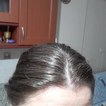 Beyazları Kapatmayan Ve Turunculaşan Saç Boyası