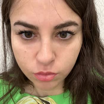 Clinimed Botox and Filler Treatment Left Me Disappointed Twice
