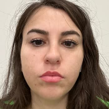 Clinimed Botox and Filler Treatment Left Me Disappointed Twice