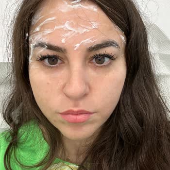 Clinimed Botox and Filler Treatment Left Me Disappointed Twice