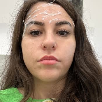 Clinimed Botox and Filler Treatment Left Me Disappointed Twice