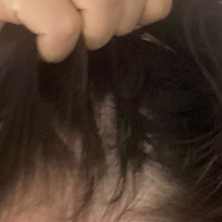 Yves Rocher Ürünleri Saç Dökülmesine Sebep Oluyor