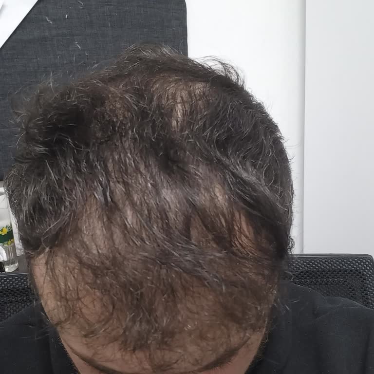 Esteworld'de Hayal Kırıklığı: Yanıltıcı Tedavi Ve Maddi Kayıp