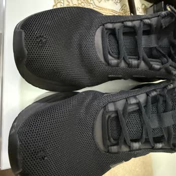 Adidas Ayakkabılarda Tekrarlayan Deformasyon Sorunu