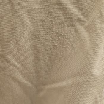 Kiğılı Gömlek Kalitesi Ve Müşteri Hizmetleri Hayal Kırıklığı