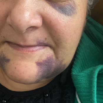 CenterDent Mağdur Olduk