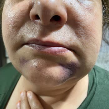 CenterDent Mağdur Olduk