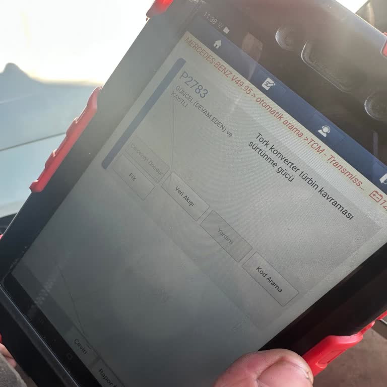 Mercedes E 250 Şanzıman Sorunu