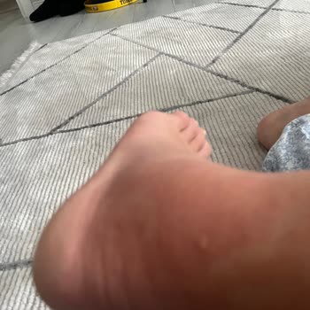 Yanlış Tedavi Nedeniyle İyileşemeyen Ayak Sorunu