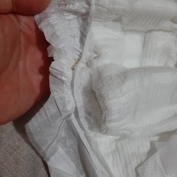 Molfix Pure Soft'ta Beklenmedik Kalite Sorunu